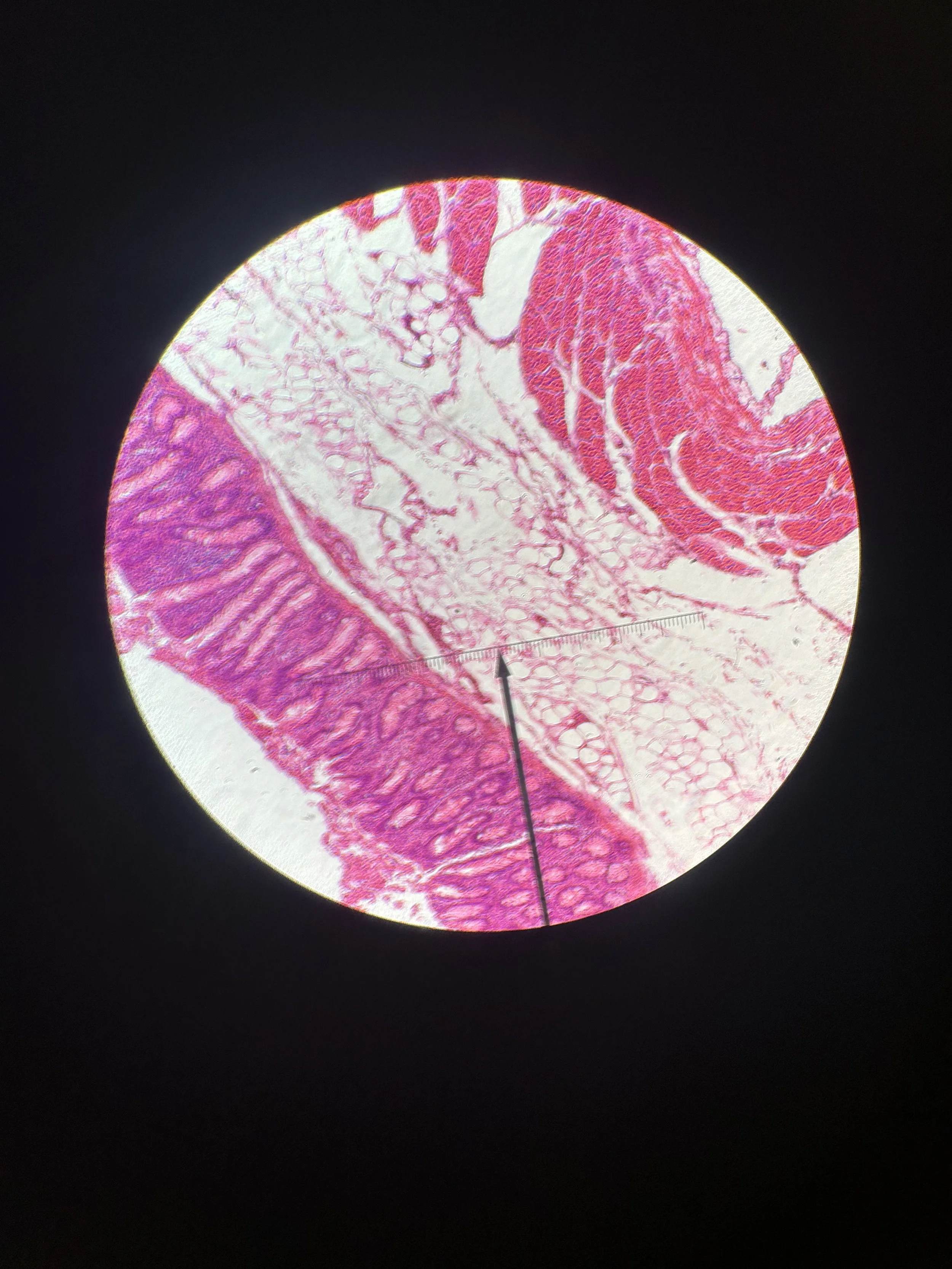 312444 human glandular epithelial 