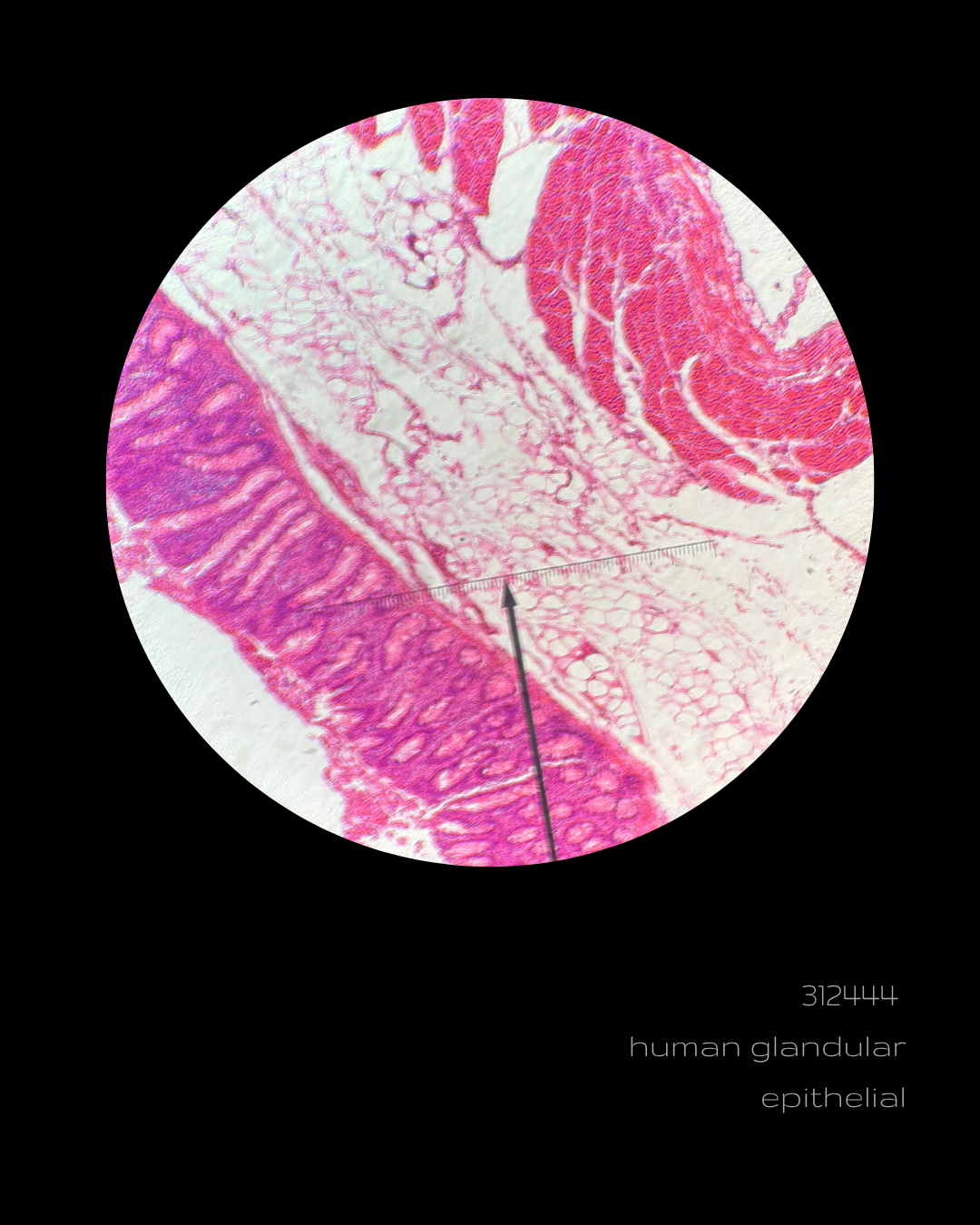 SPLICE - 312444 human glandular epithelial.png