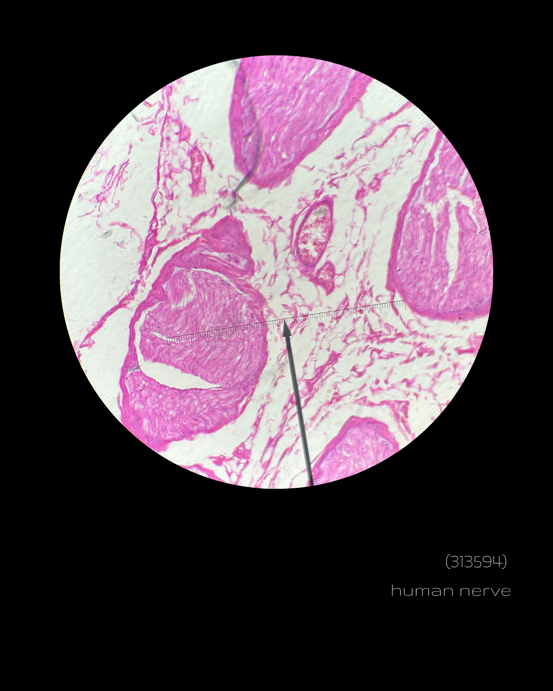 SPLICE  - (313594)  human nerve.png