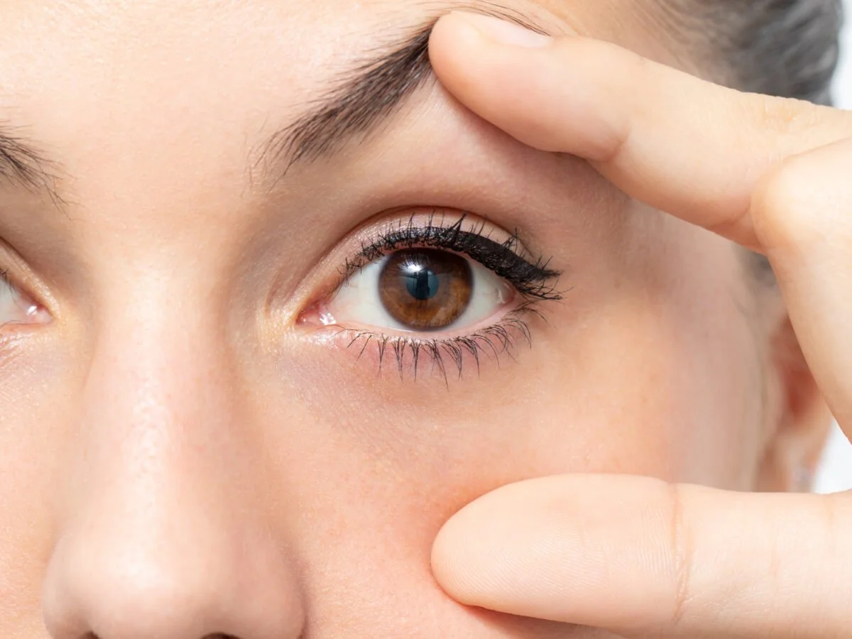 Schlupflidkorrektur bei plastischer & ästhetischer Chirurgie St. Moritz