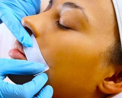 A person receiving a facial treatment with a white mask applied to their cheek by a practitioner wearing blue gloves.