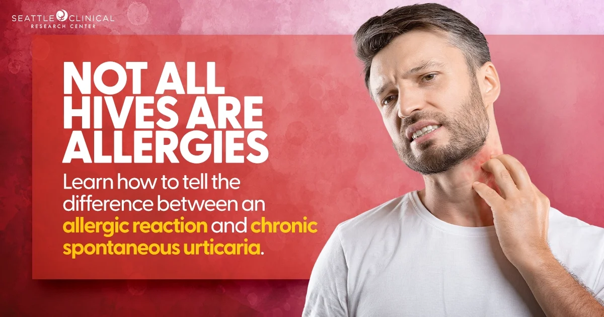 The Difference Between CSU and Allergic Reactions