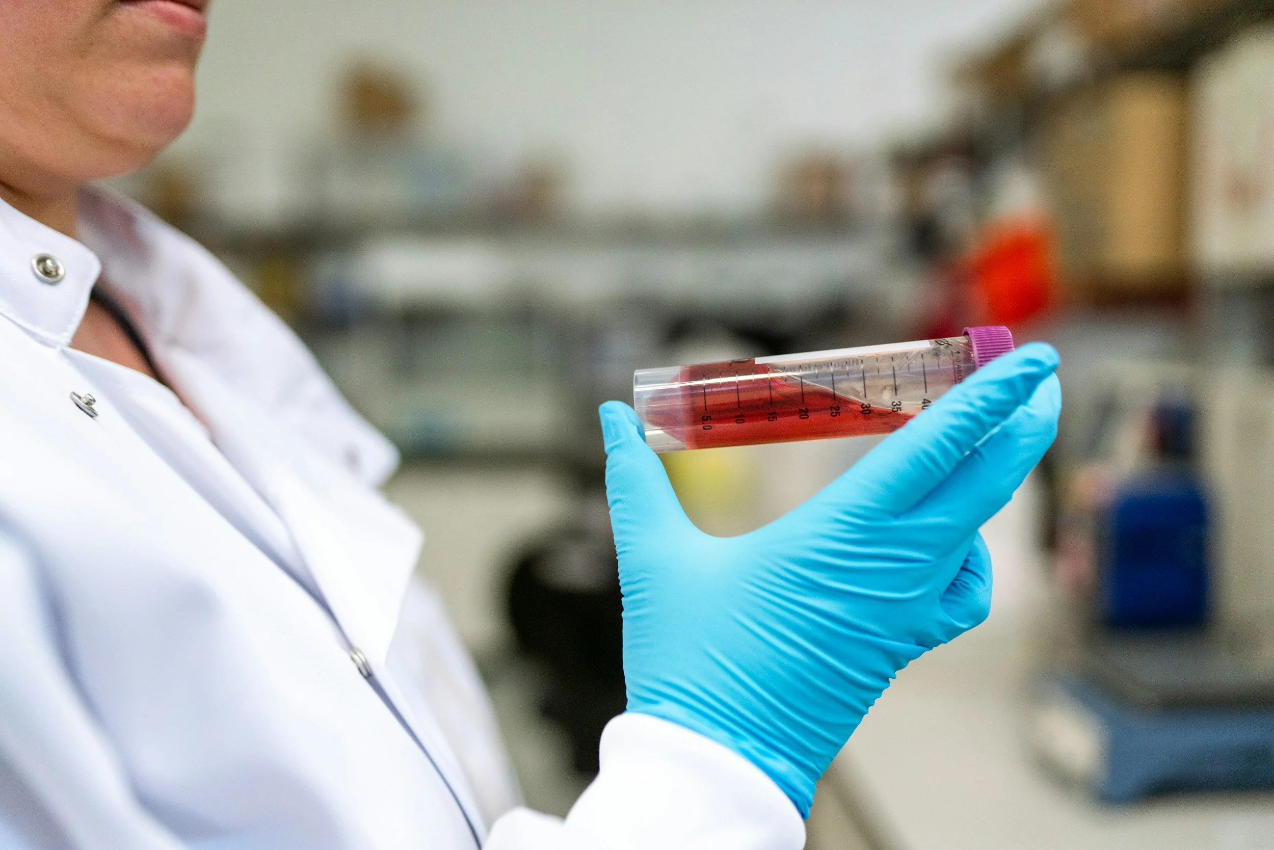A person in a white lab coat holding a test tube filled with blood, wearing blue gloves, in a laboratory setting.