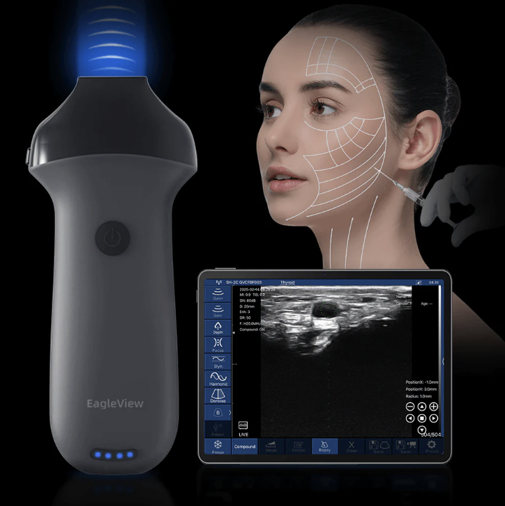 A woman receiving a cosmetic ultrasound treatment on her jawline, with a handheld ultrasound device aimed at her face and a screen displaying a thyroid ultrasound image.