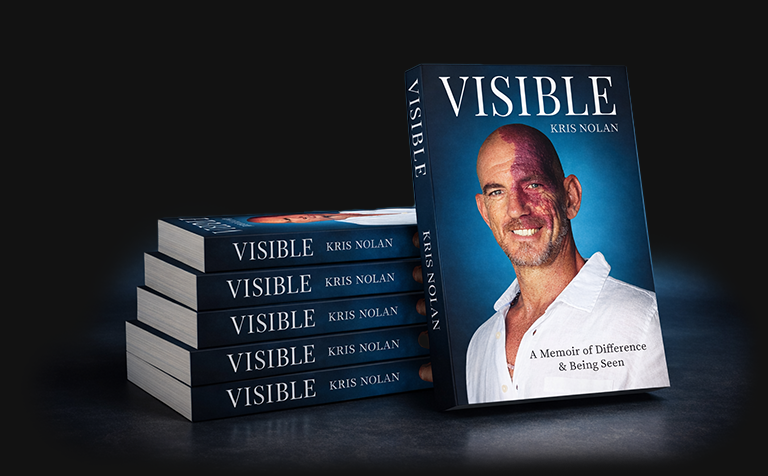 Stack of VISIBLE by Kris Nolan, a memoir about growing up with a facial port-wine stain birthmark.