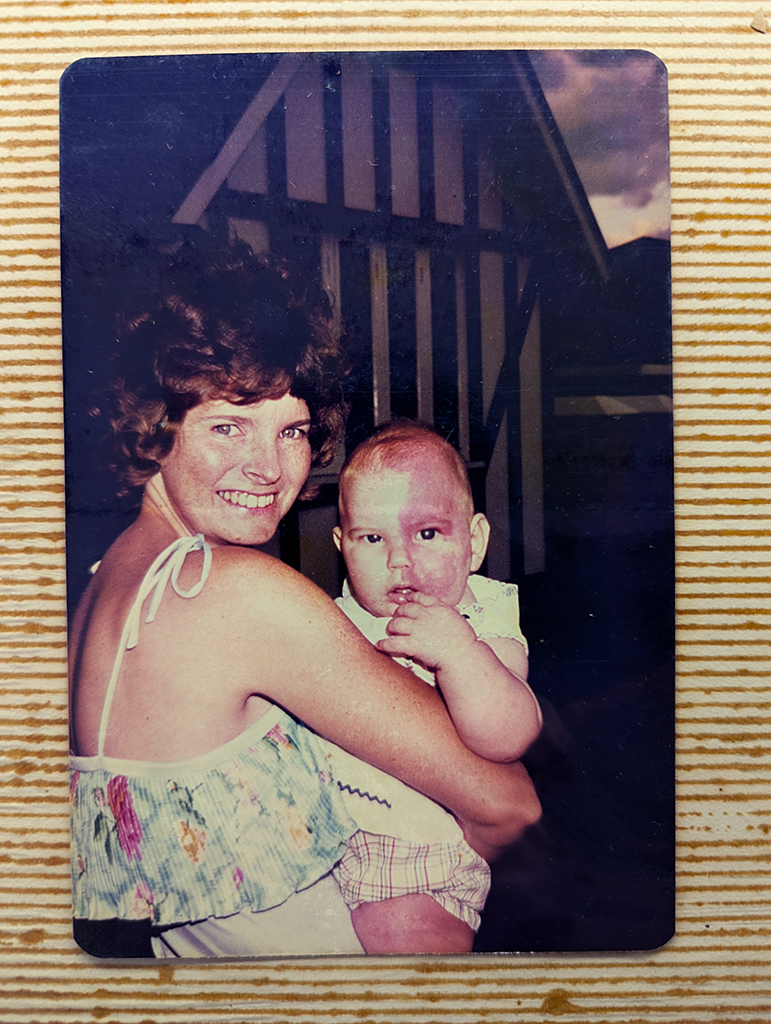 Kris Nolan as a baby with his mother, showing the early presence of his port-wine stain birthmark.
