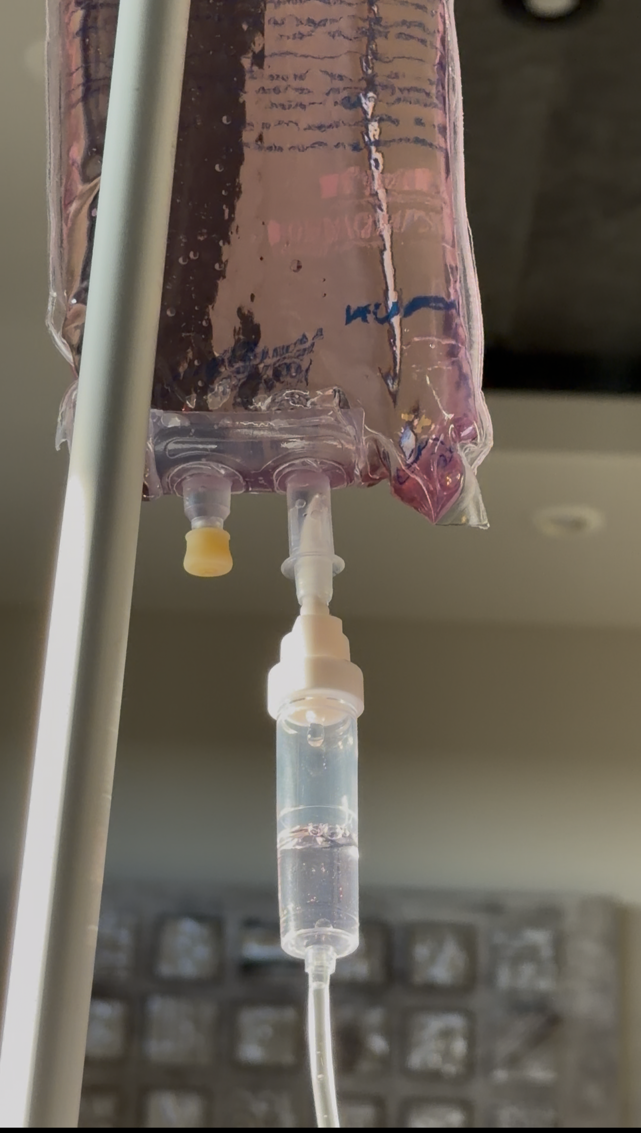 Close-up of an IV bag with clear fluid, connected to a tube, hanging on a metal pole in a medical setting.
