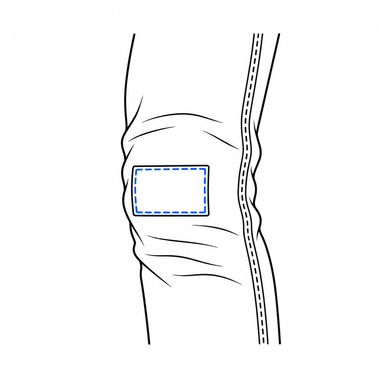 Jeans patch repair diagram