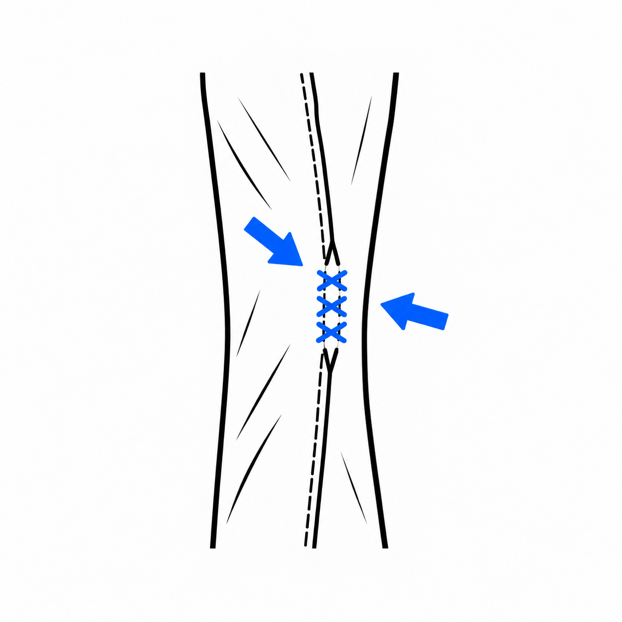 Dress pants open seam repair diagram