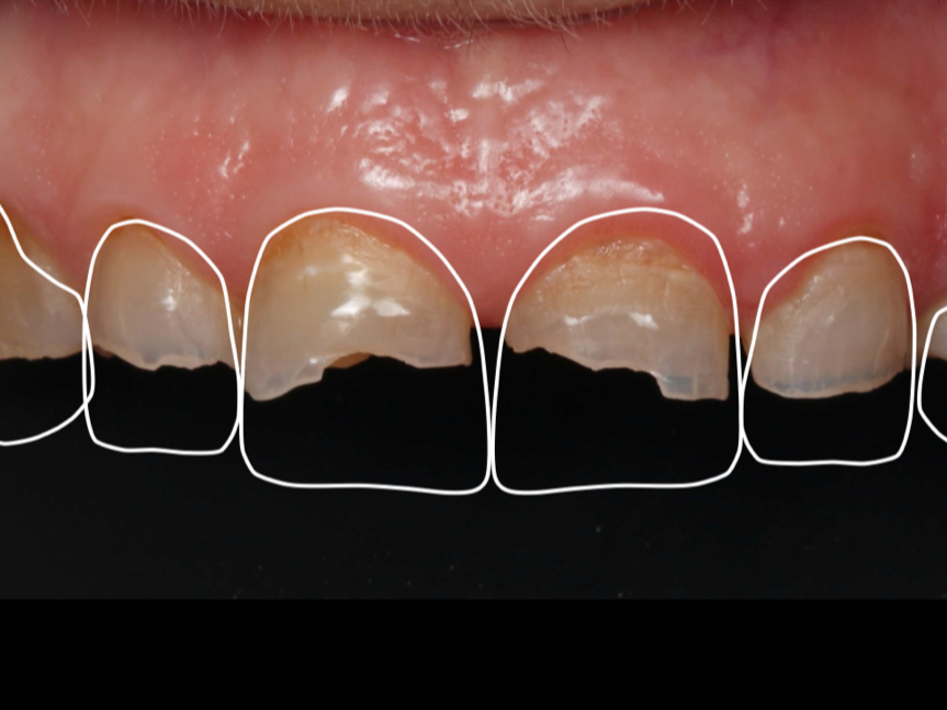 Digital Smile Design por la Dra. Violeta Voicu