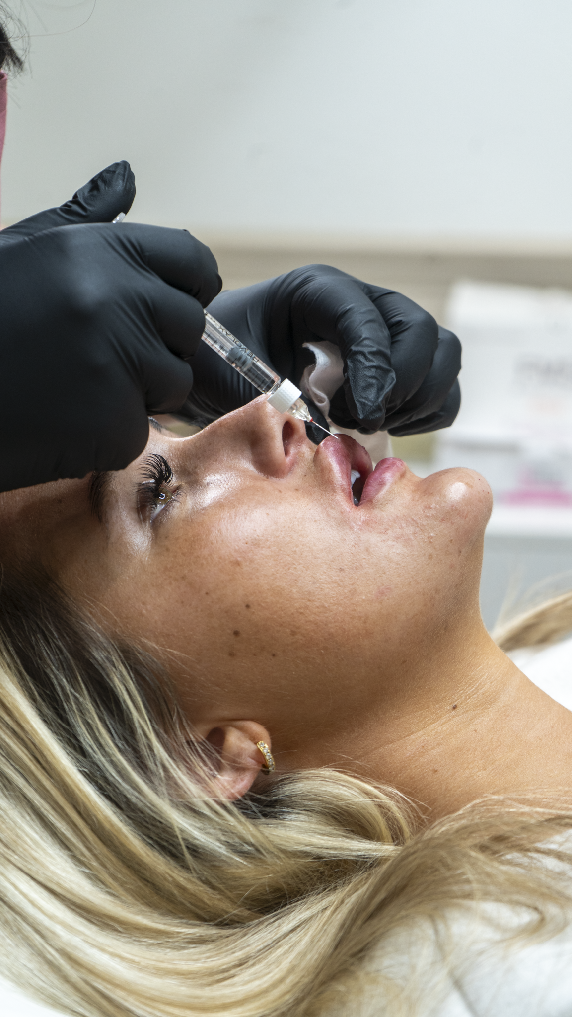 A woman lying down receiving a nasal injection from a healthcare provider wearing black gloves.