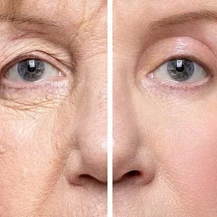 Facelift, neck lift, rhinoplasty, fat grafting, eyelid surgery, browlift, chin augmentation, cosmetic facial surgery, brampton cosmetic surgery, brampton plastic surgery, vaughan plastic surgery, etobicoke plastic surgery, plastic surgeon
