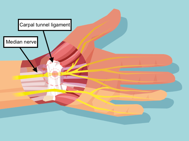 Skin cancer surgery, melanoma surgery, basal cell cancer surgery, squamous cell cancer surgery, minor procedure surgery, cyst removal, xanthoma removal
Carpal tunnel surgery, trigger finger surgery, finger surgery, hand fracture surgery, dupuytren