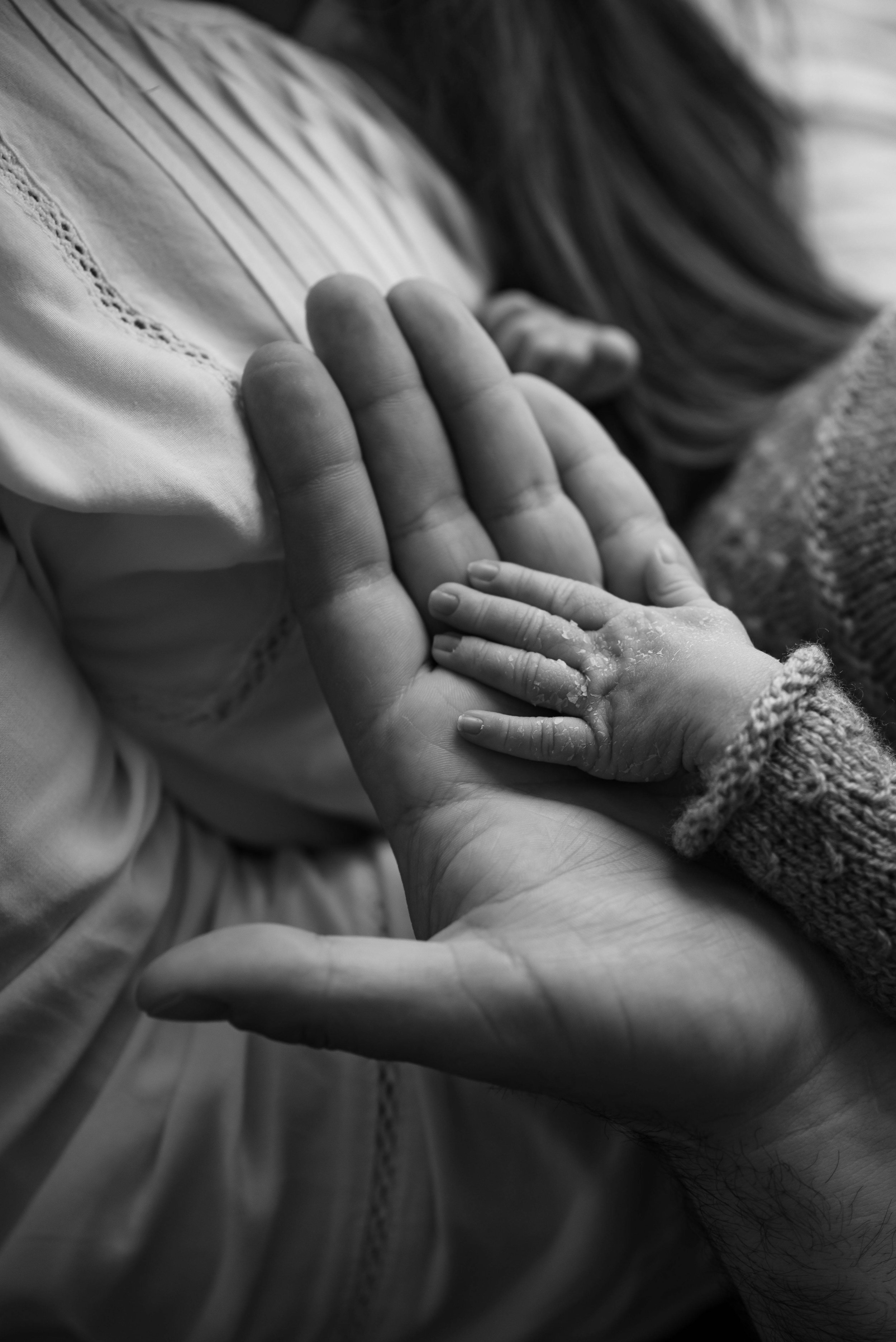 A large adult hand gently holding a tiny child's hand, both resting on a person's chest. The child's hand has some flakes of skin and is wearing a cozy sweater.