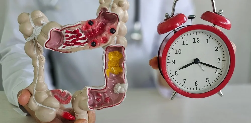 How to Increase Gut Motility? What it is and Why You’ll Feel Better After