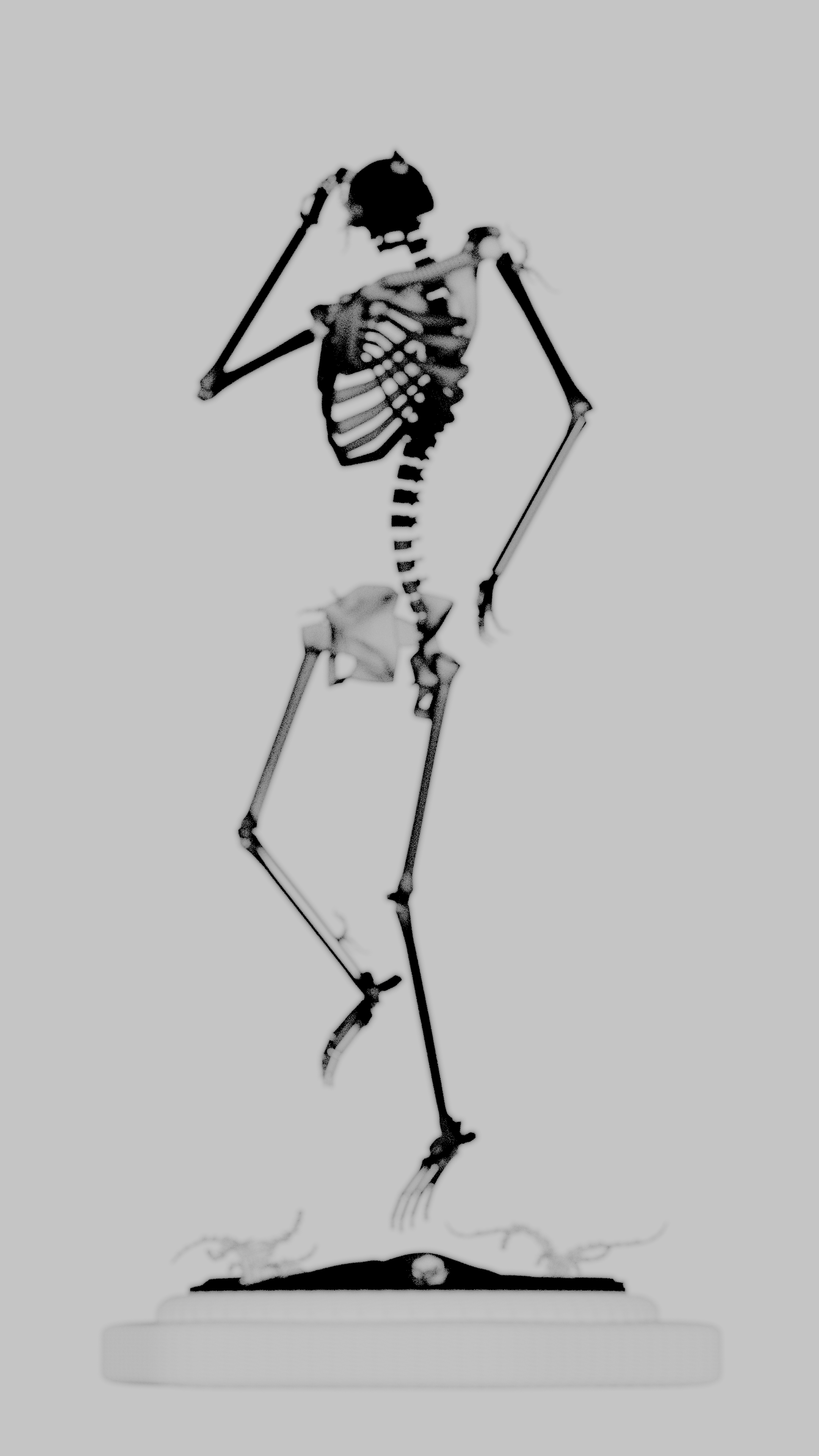 Xray.png