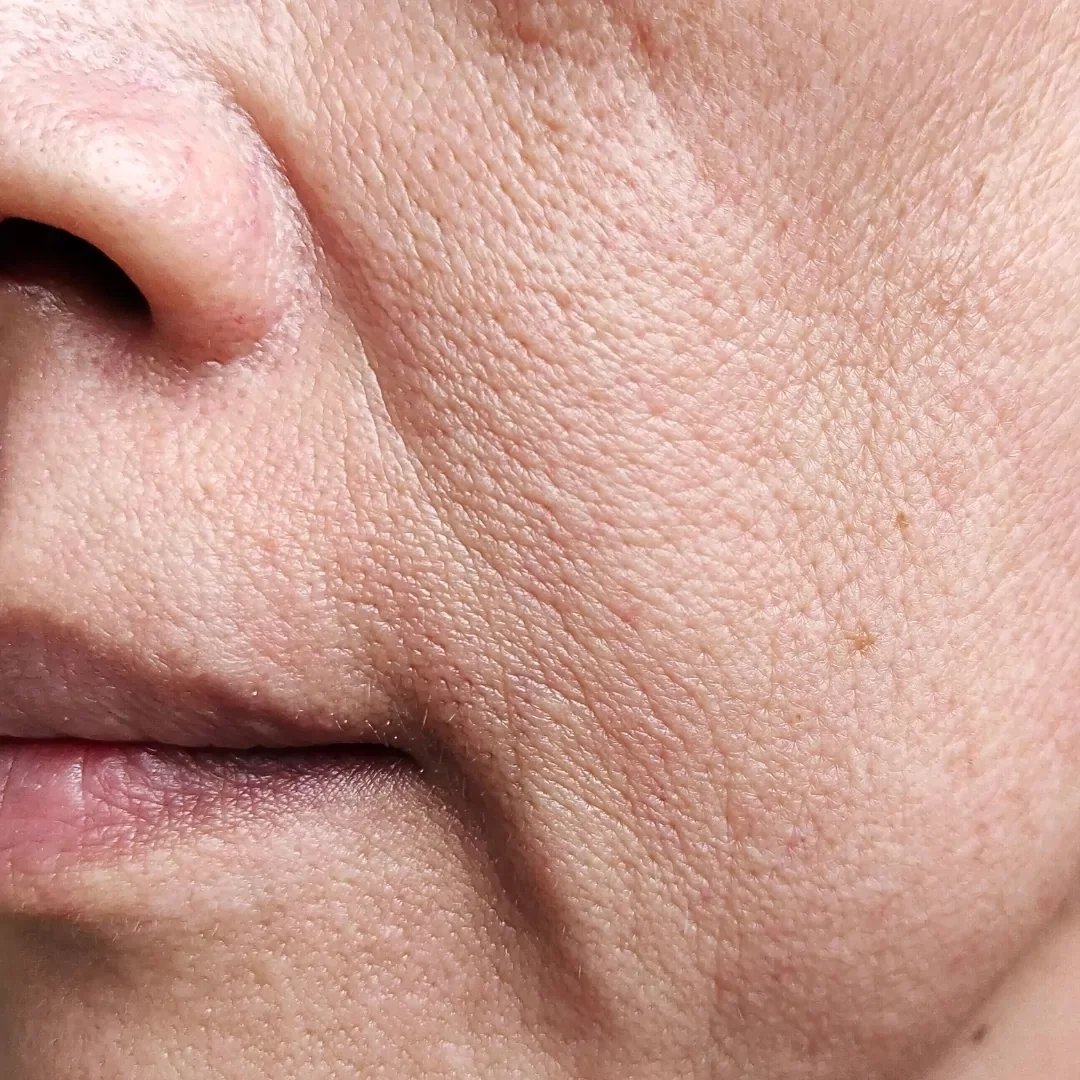 Close-up of a person's face, showing the skin texture around the nose, cheek, and lips.