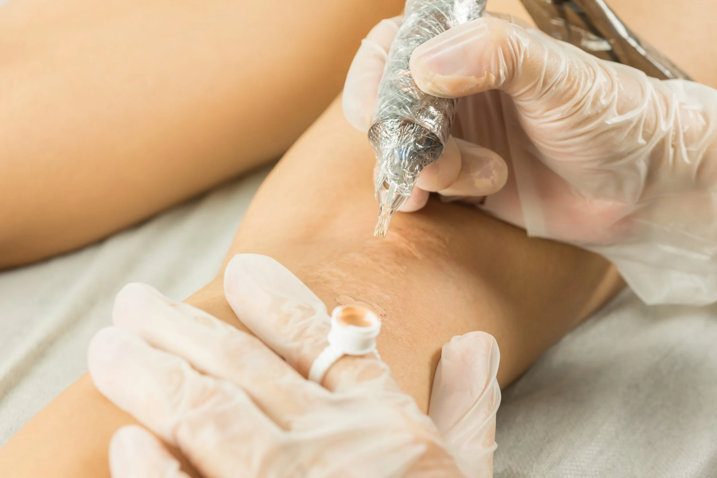 A person receiving a tattoo on their forearm, with a tattoo artist using a tattoo machine, both wearing gloves.