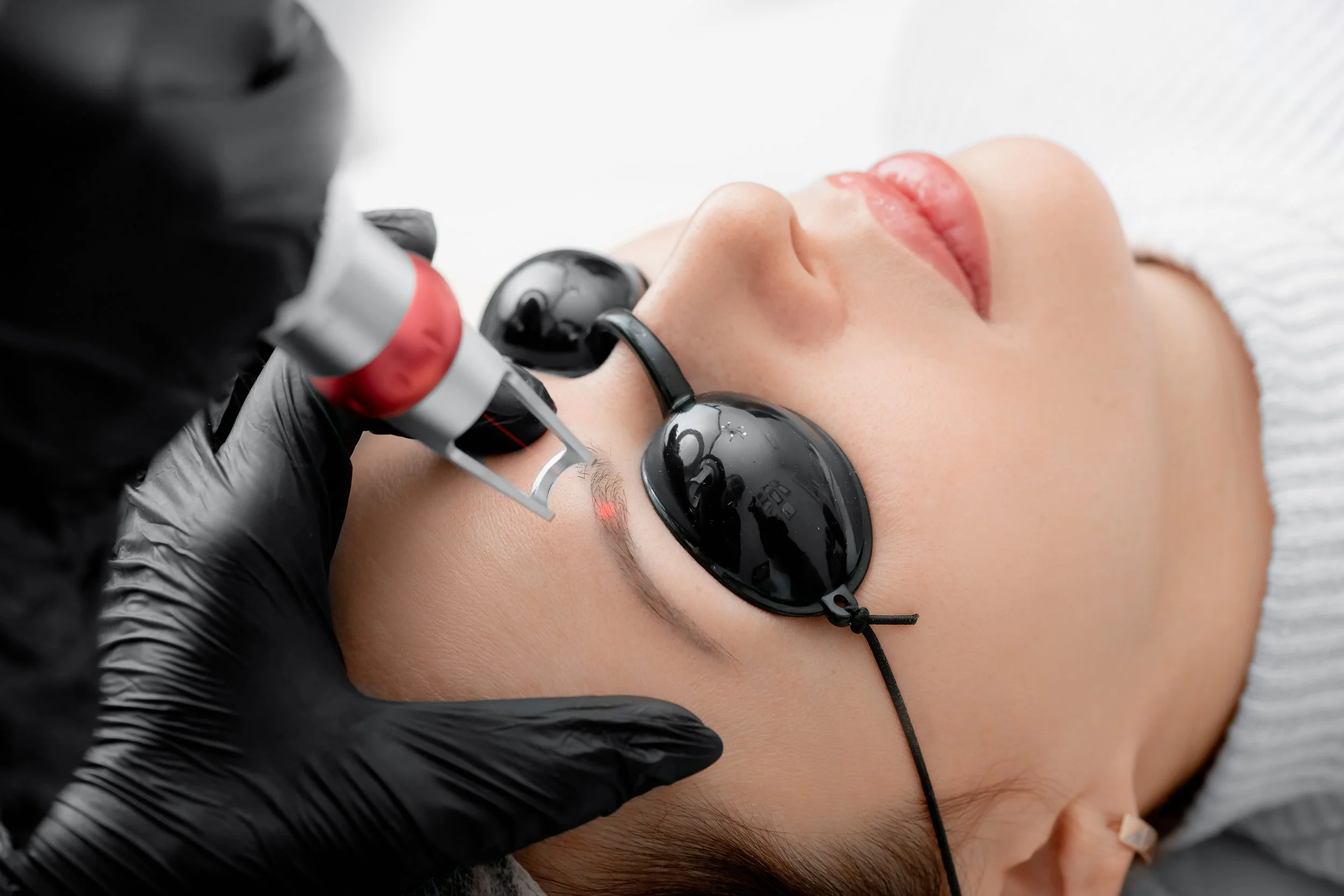 Hands-on laser tattoo removal training on eyebrow area