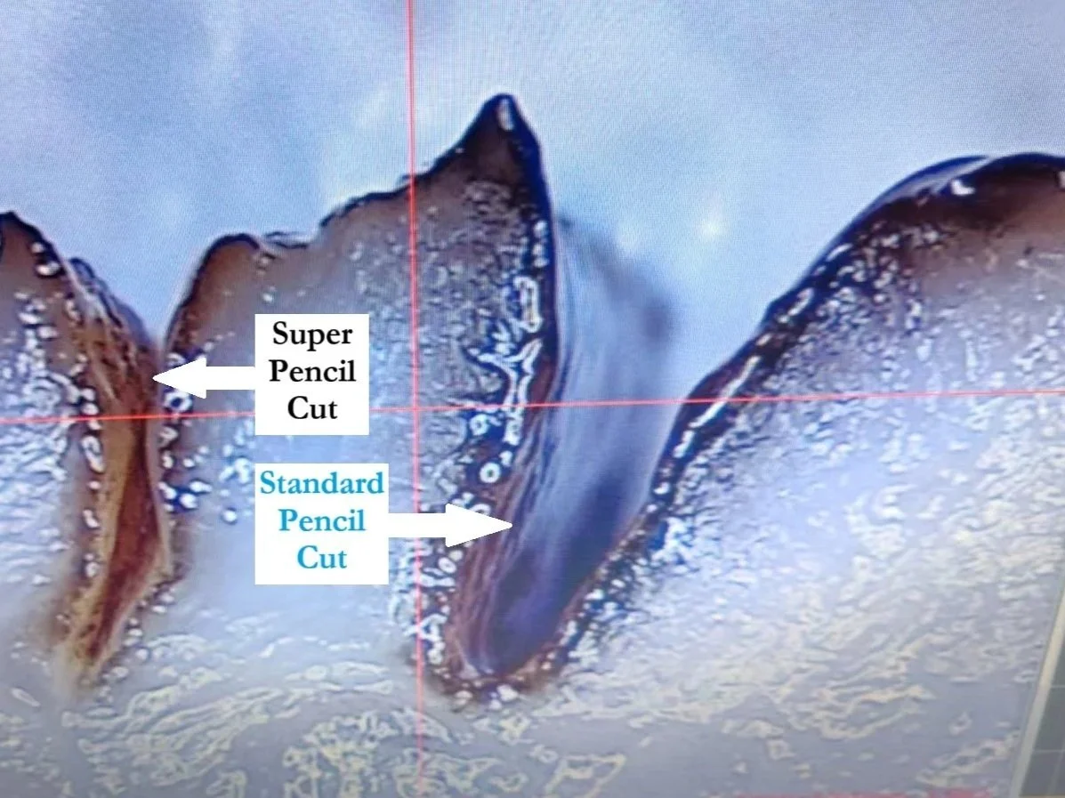Histology image showing pig skin tissue margins following electrosurgical incision with the Super Pencil
