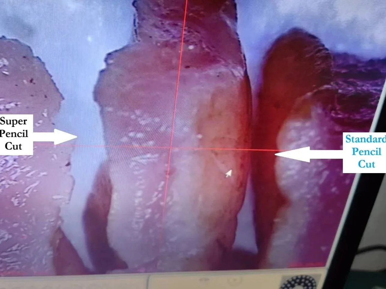 Histology image showing pig muscle tissue margins following electrosurgical incision with the Super Pencil