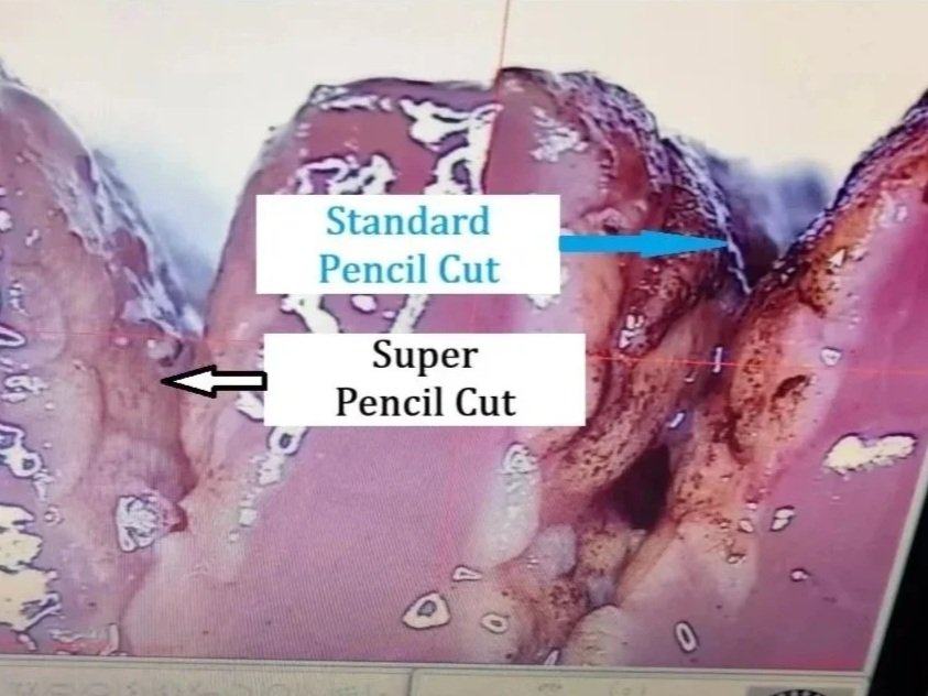 Histology image showing pig liver tissue margins following electrosurgical incision with the Super Pencil