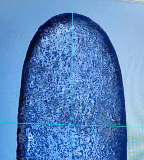 Close-up of RF electrosurgical electrode showing proprietary non-stick ceramic coating