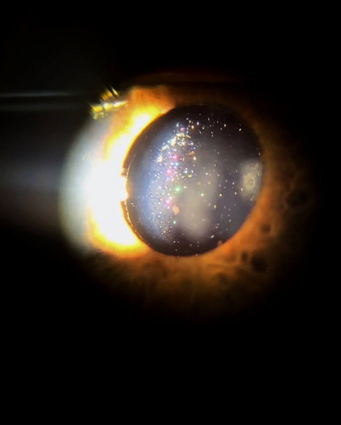 Close-up of a small, shiny, spherical object with colorful reflections, surrounded by a glowing orange and yellow ring of fire or light.
