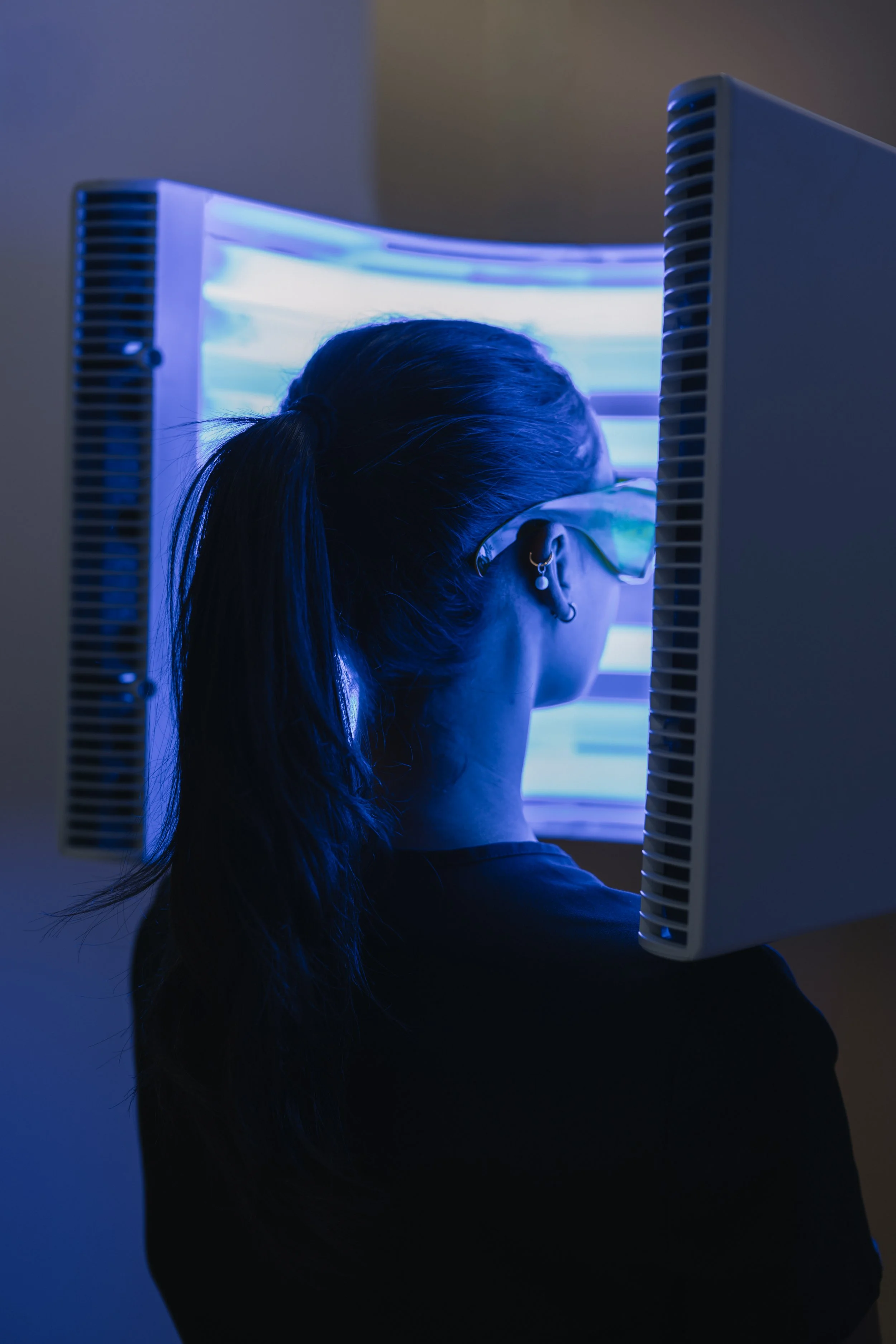 Acne Treatment Edmonton Laser Sheer