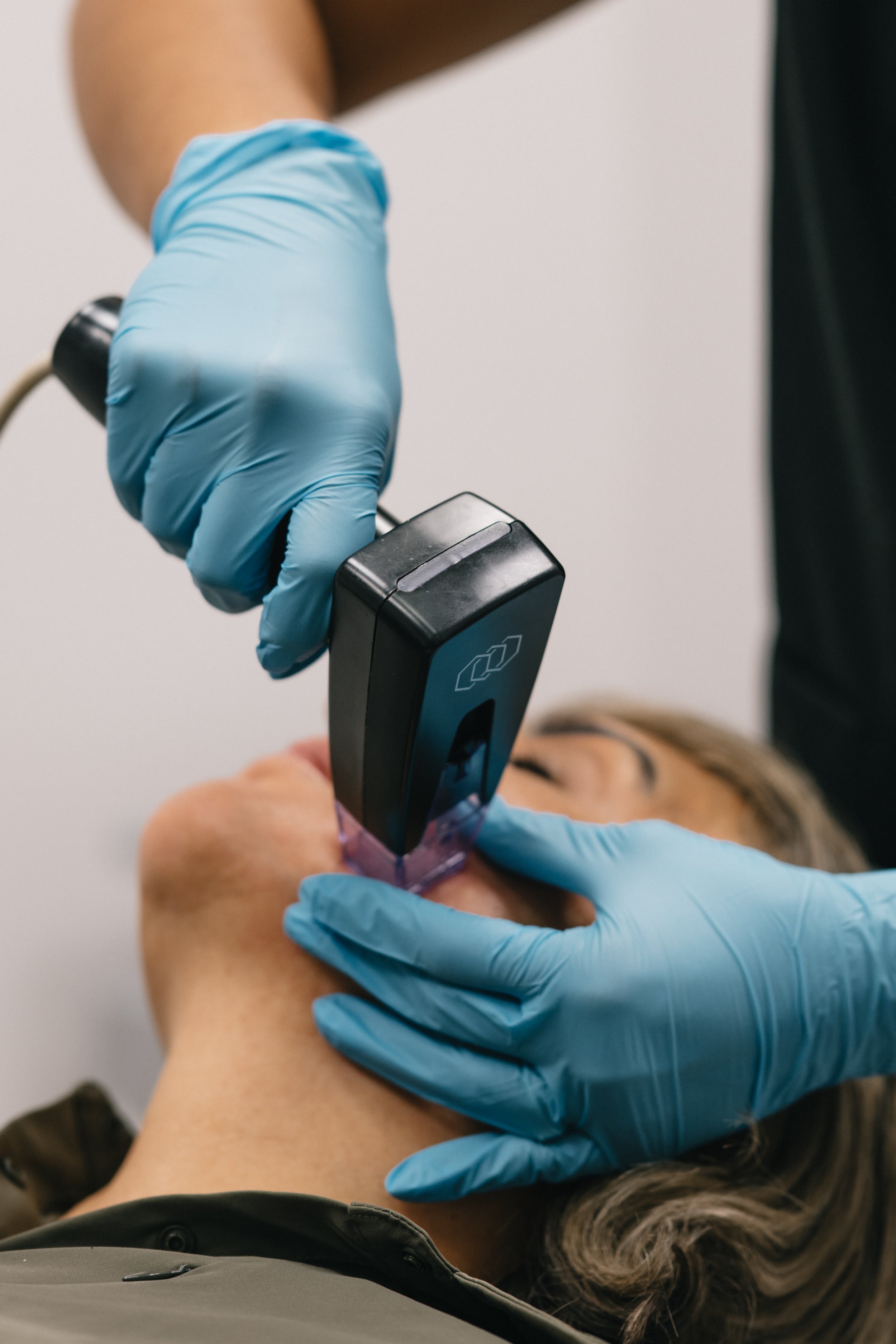 Laser Sheer Morpheus Edmonton