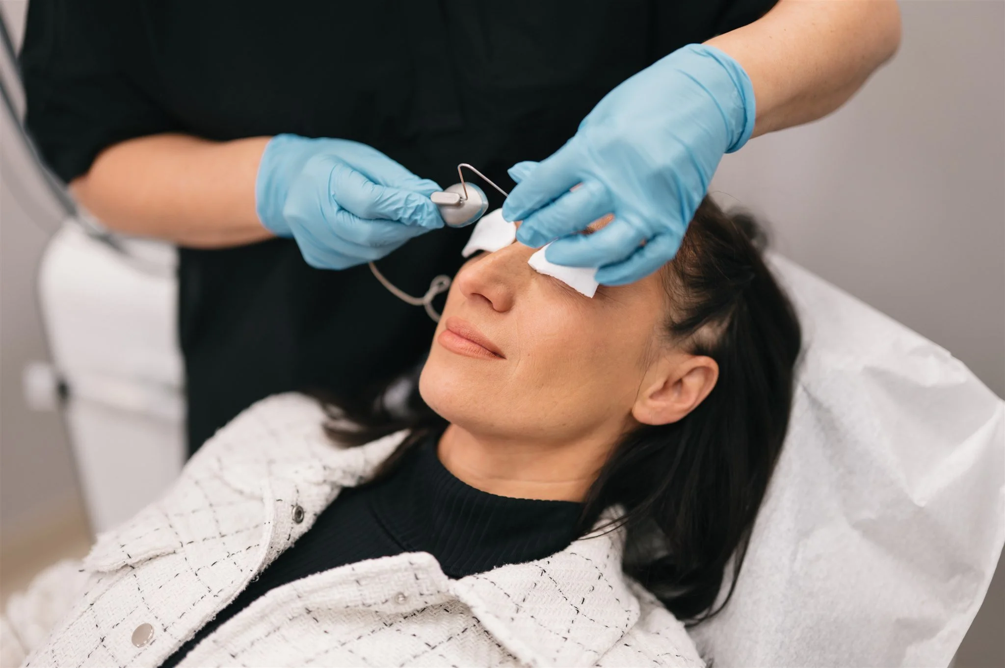 Acne Treatments Laser Sheer Edmonton