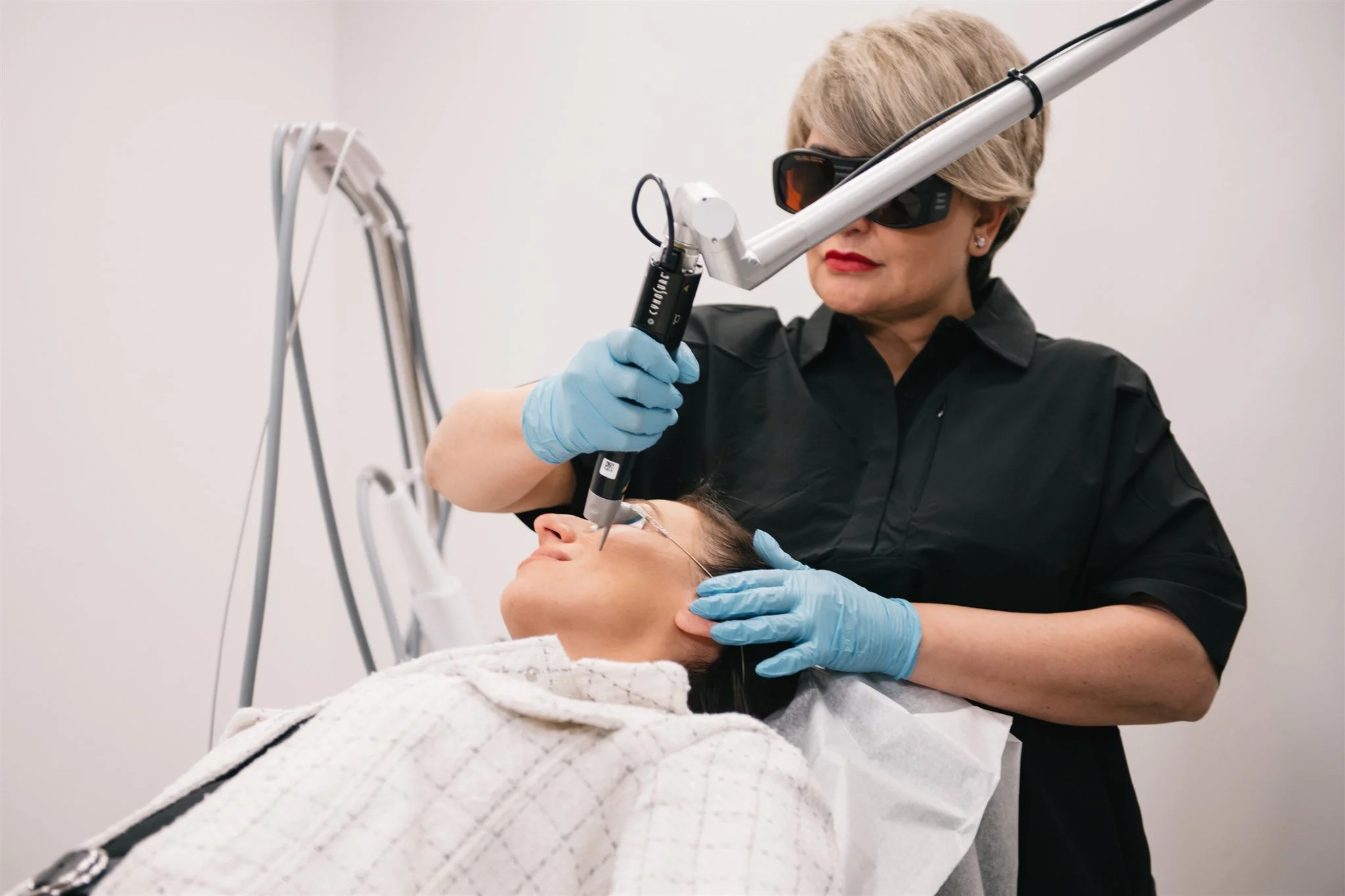 Acne Scarring Treatment Laser Sheer Edmonton