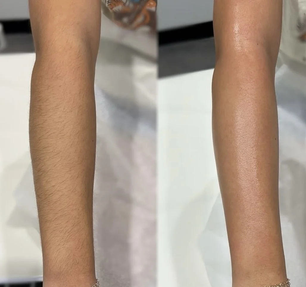 Before and after arm waxing results showing smooth, hair-free skin