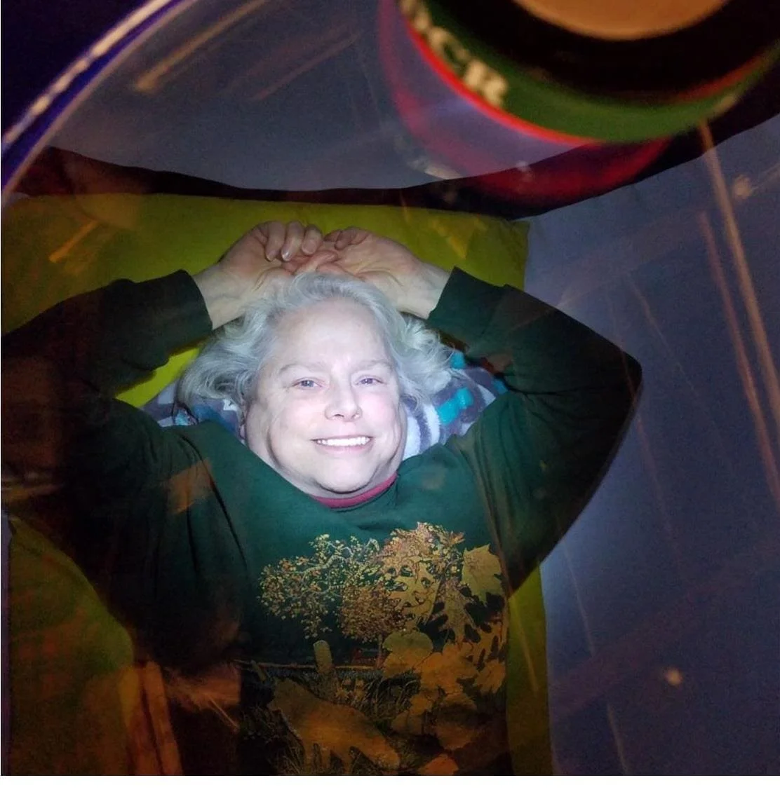 The efficacy of hyperbaric oxygen therapy in the management of chronic fatigue syndrome