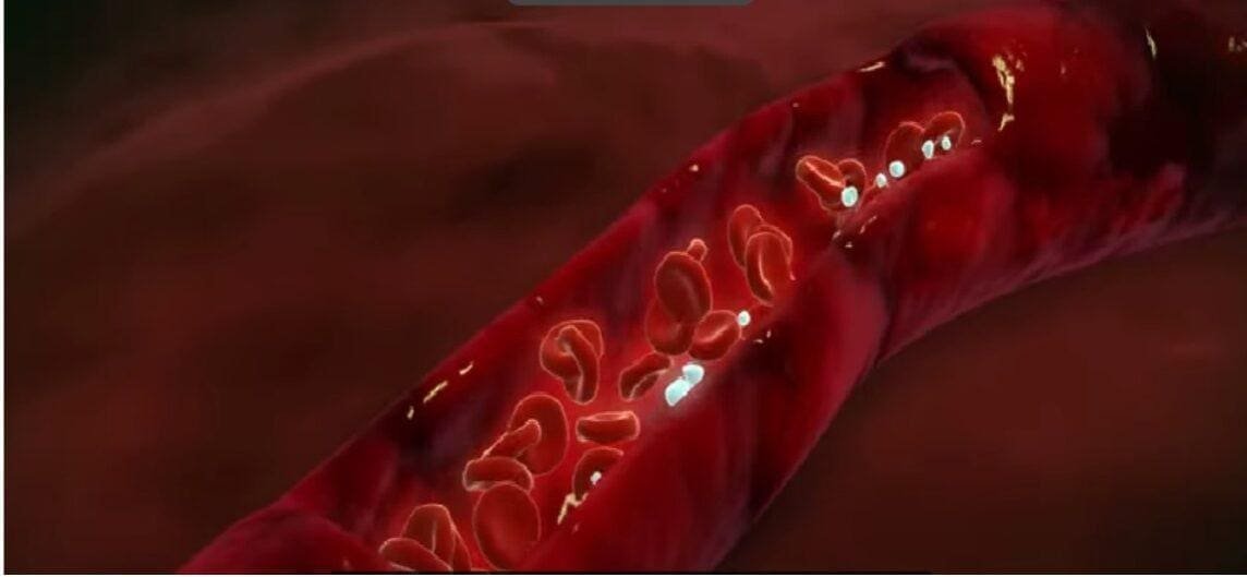 Uncovering the Secrets of Hyperbaric Oxygen Therapy: Could This Be a Cure for Cancer?