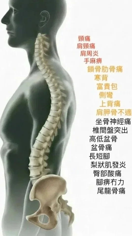 Diagram of the human spine with Chinese text pointing to various areas indicating different types of pain and discomfort, including neck pain, shoulder pain, back pain, and sciatic nerve pain.