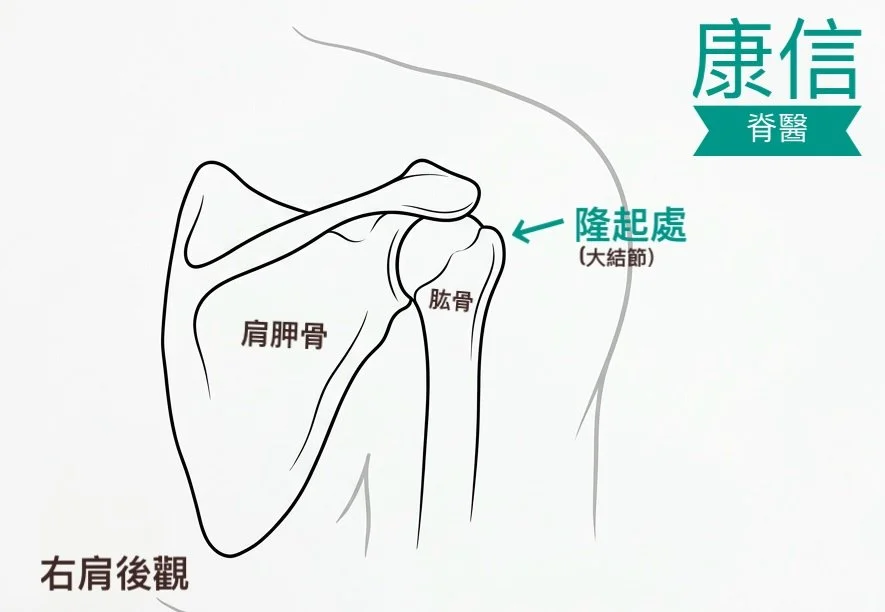 肩周炎