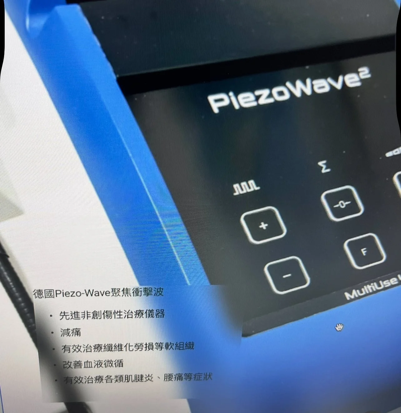 德國聚焦衝擊波治療Piezo-wave 2. Trigger point therapy, tennis elbow, golfer's elbow, planter fasciitis