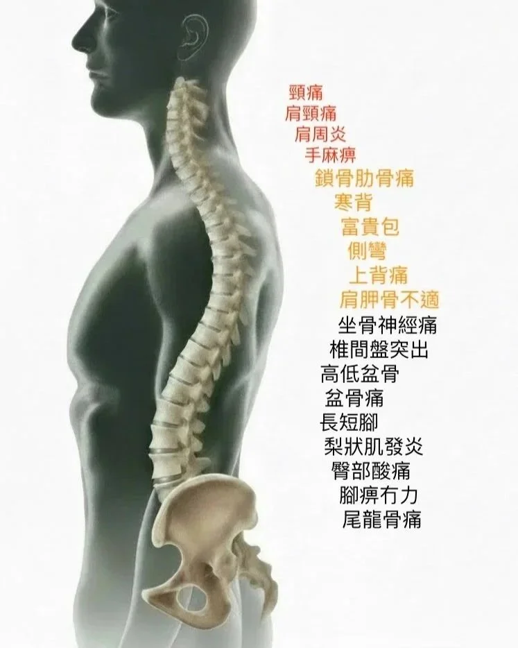 Diagram of the human spine and pelvis with labels in Chinese indicating various pain points and medical conditions affecting the neck, shoulders, back, hips, legs, and tailbone.