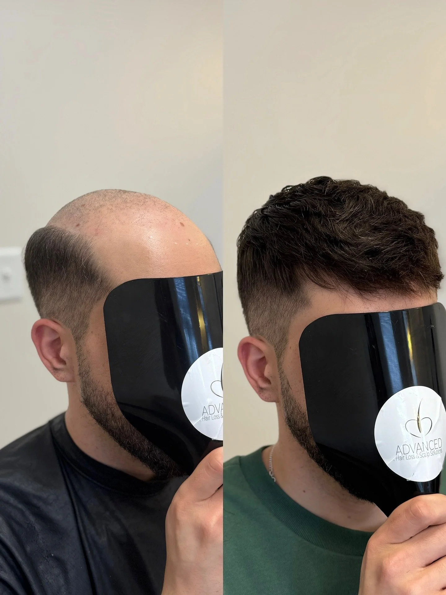 Perfecting the craft one client at a time #hairsystem #hairloss #menshairsystem