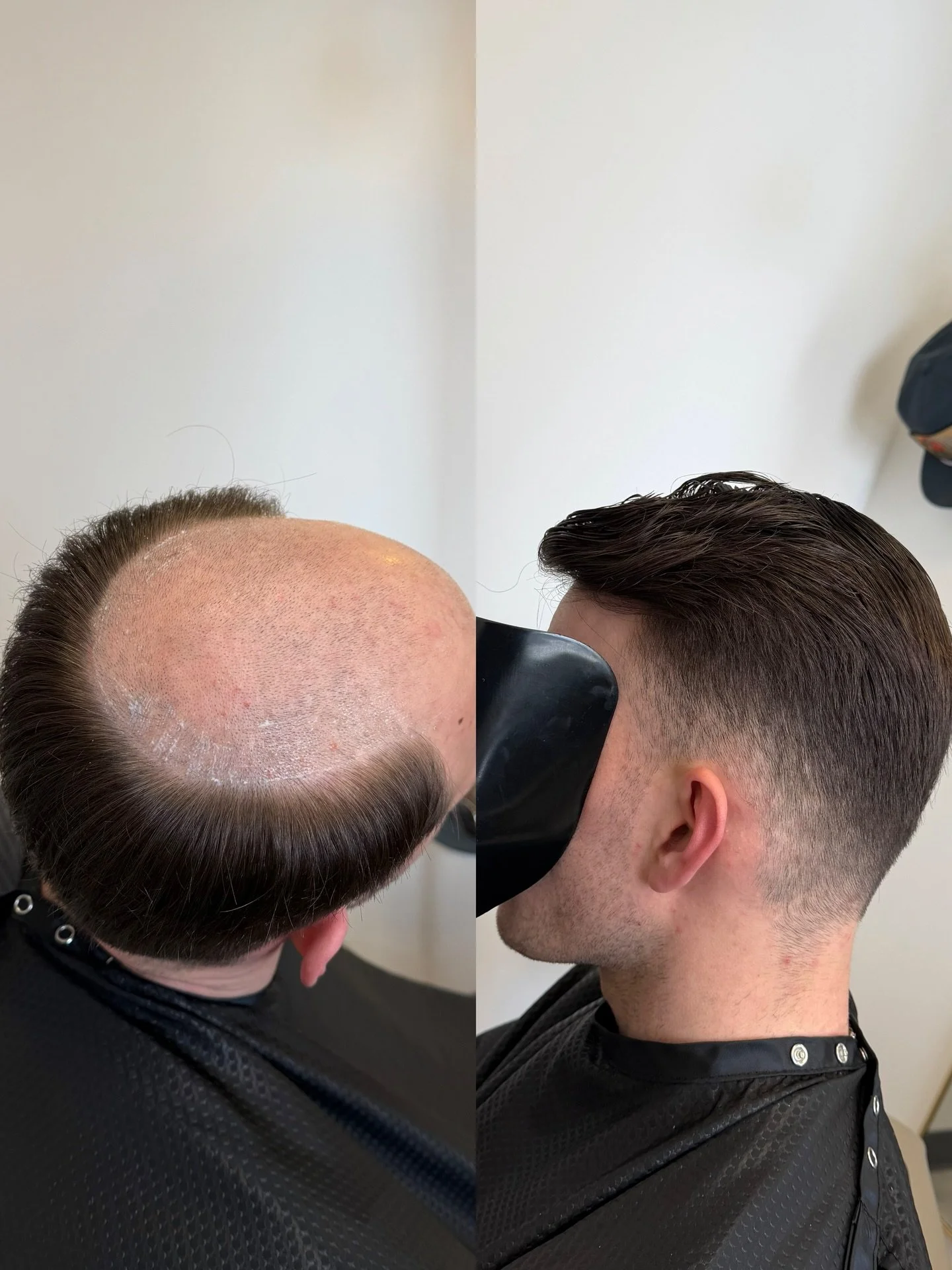 The mid fade with side part will never get old #hairloss #hairreplacement #menshair 
&bull; fade: @lo_cutz