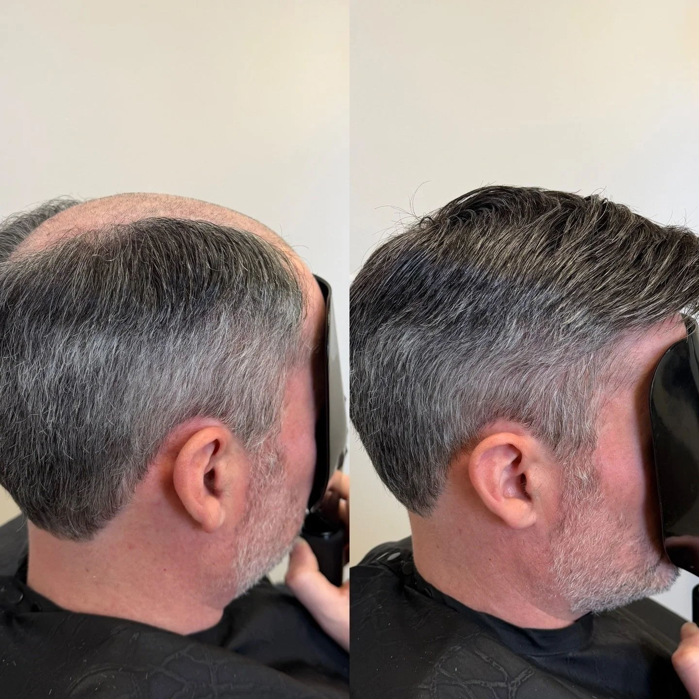 Let&rsquo;s talk about grey hair❗️very common for men to have an uneven grey distribution. I highly recommend embracing your natural color instead of trying to color it. It&rsquo;s typical for the sides and nape of the neck to grey faster than any ot