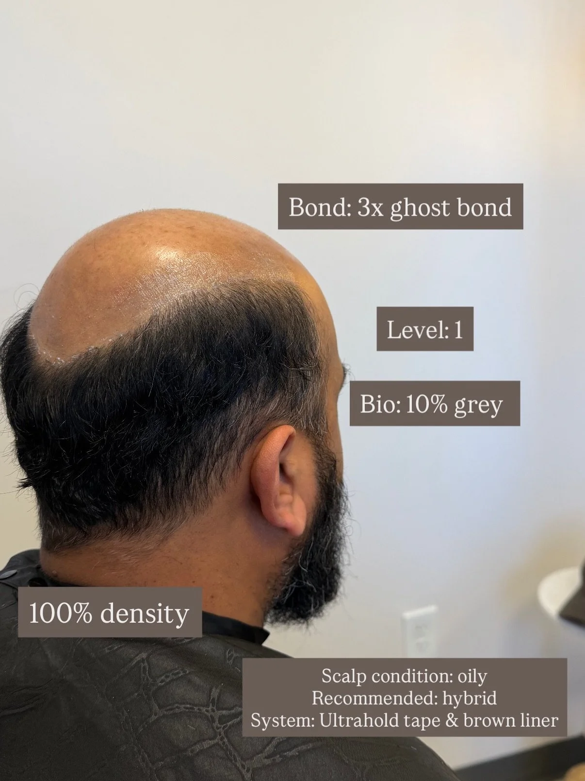 I thought this would be a great way to share my thought process as I decide what system suits the client best. #hairreplacement #menshairsystem #education