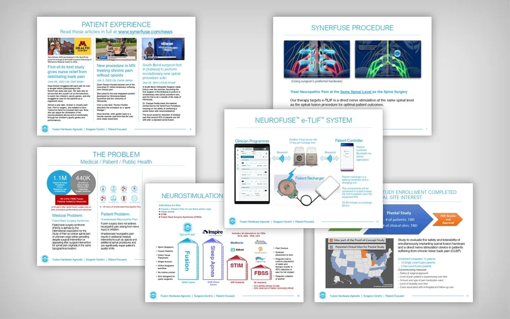 Collection of five medical presentation slides about patient experience, neurostimulation, NeuroFuse e-TLIF system, problem in healthcare, and a clinical study enrollment.