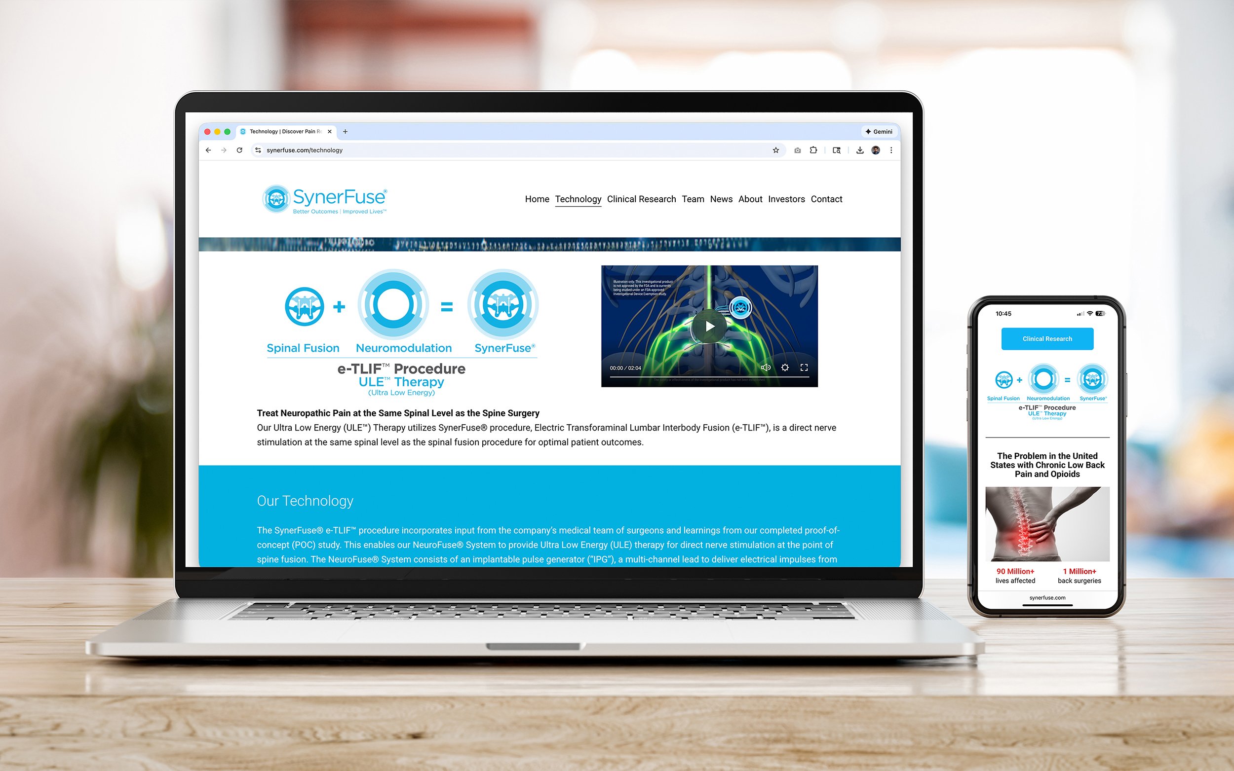 Laptop on a wooden table displaying a medical technology website related to spinal fusion and nerve stimulation; smartphone to the right showing similar medical research information.