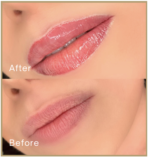 Close-up photo of lips showing before and after lip gloss application, with the top labeled 'After' and the bottom labeled 'Before'.