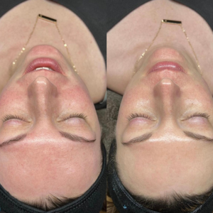 Before & After 1 Session 