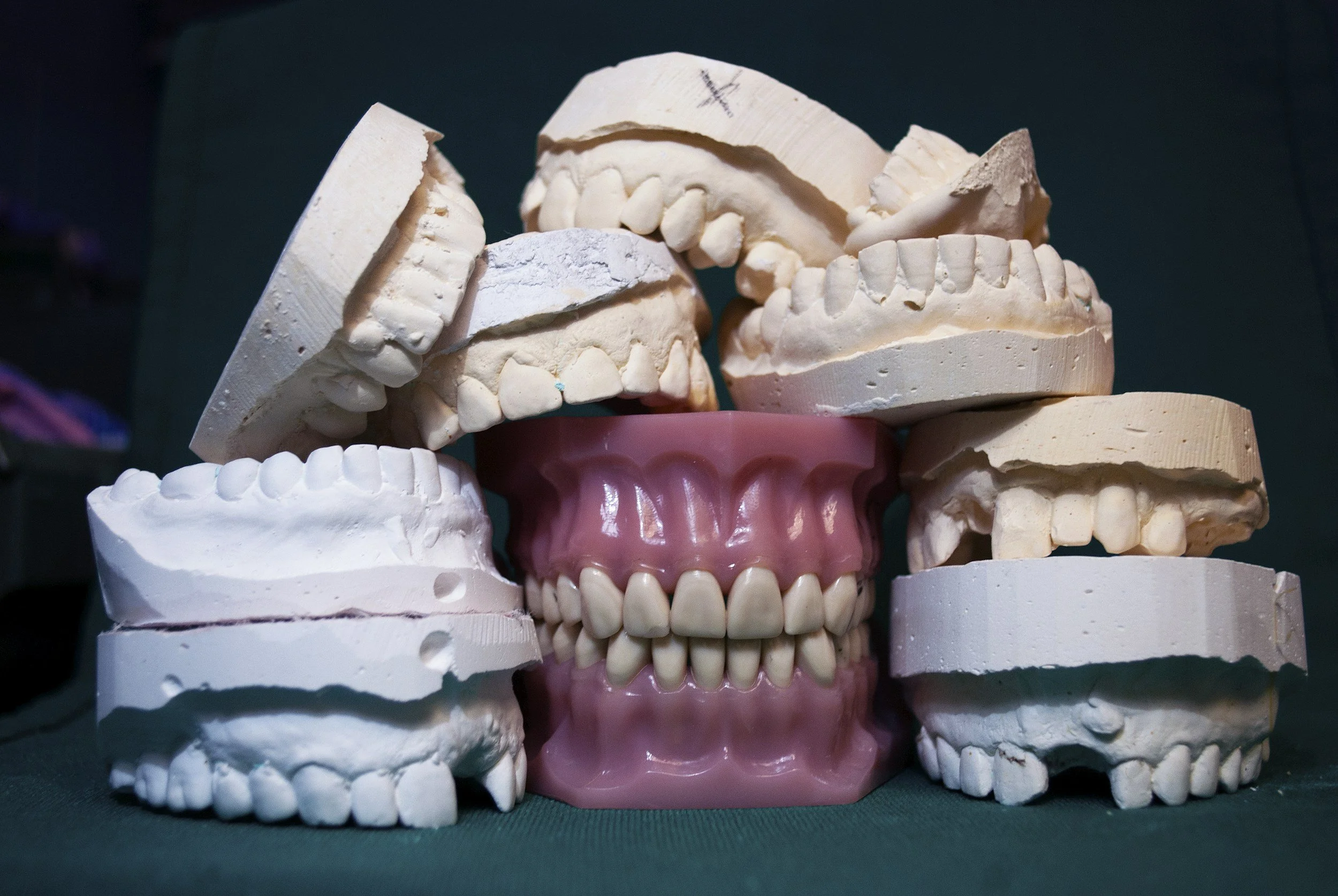 A Denture Adjustment Can Help Address Oral Atrophy