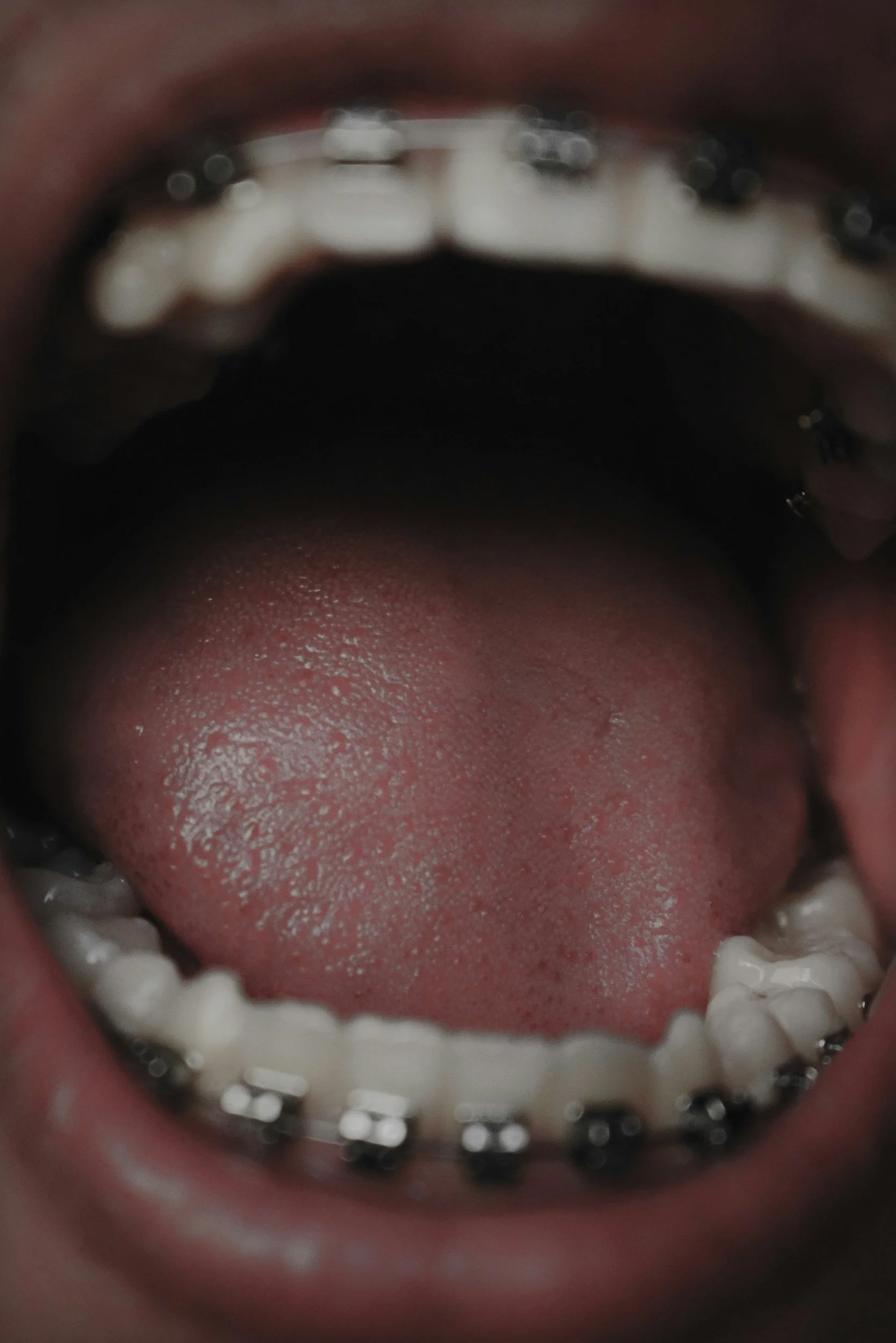 Insights on Providing Quality First Aid for an Injured Tongue