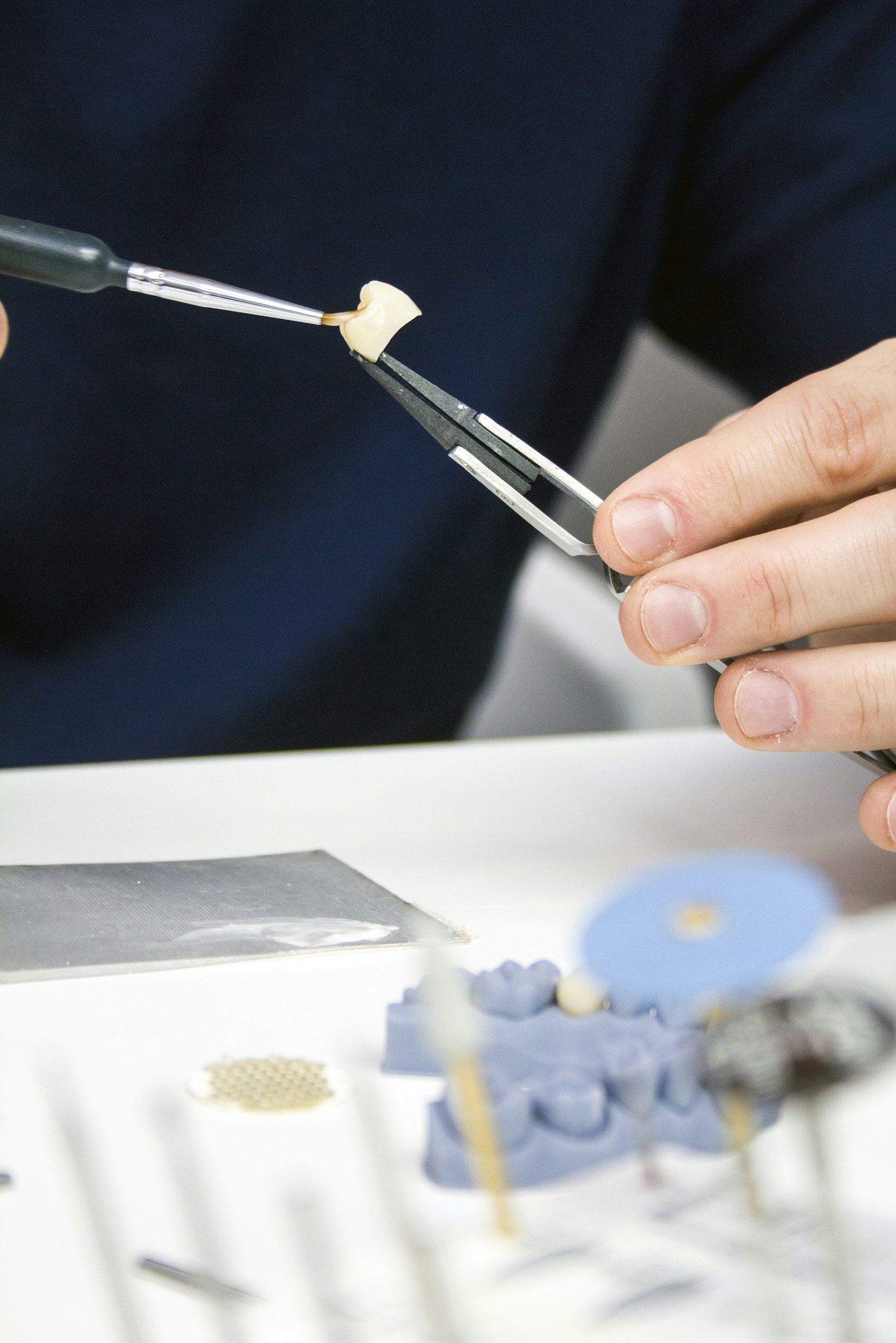 Improving a Tooth’s Cosmetic Appearance By Installing a Crown